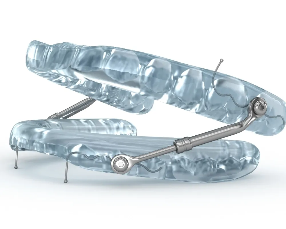 Orthodontiste enfant Puteaux 92800