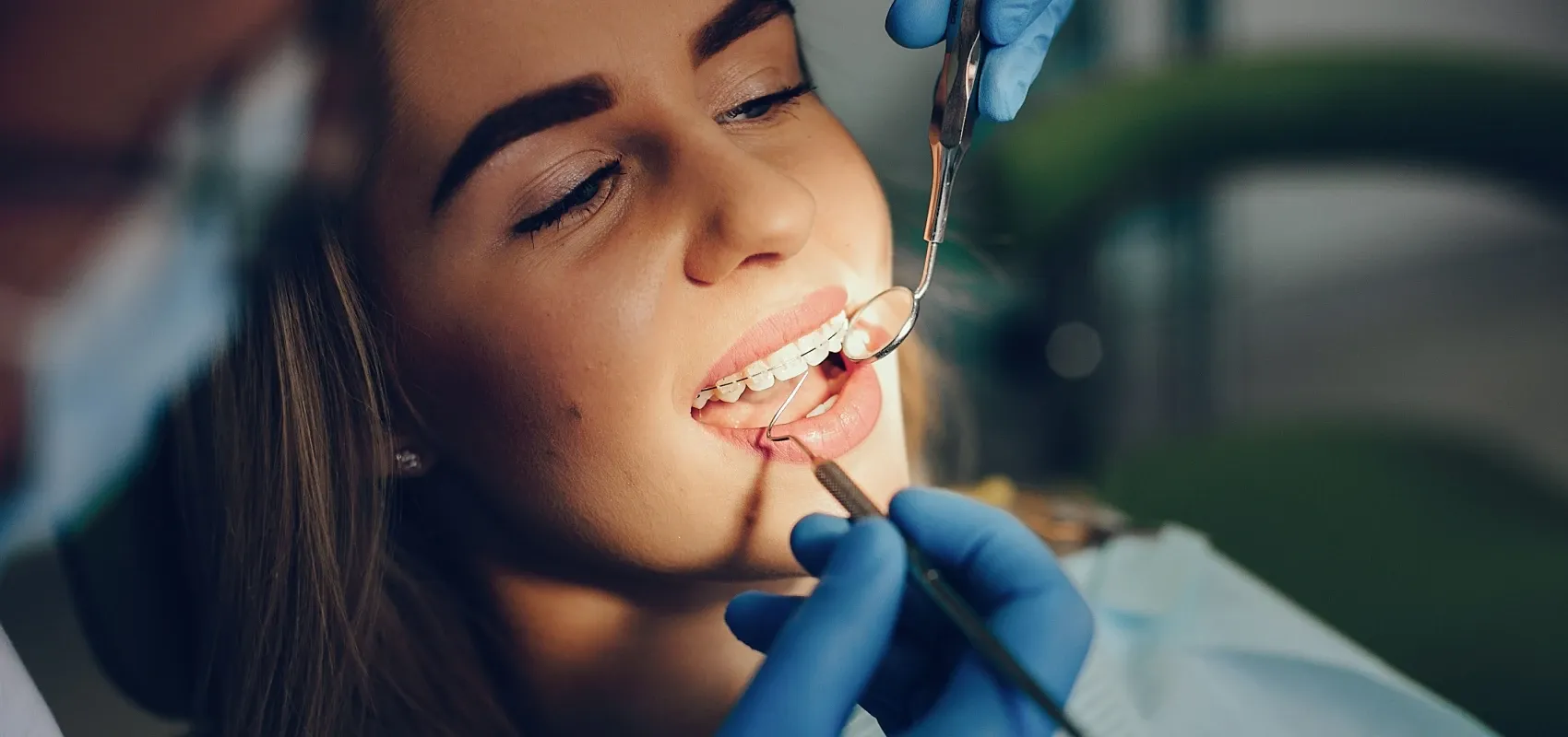 Orthodontiste adulte Puteaux 92800