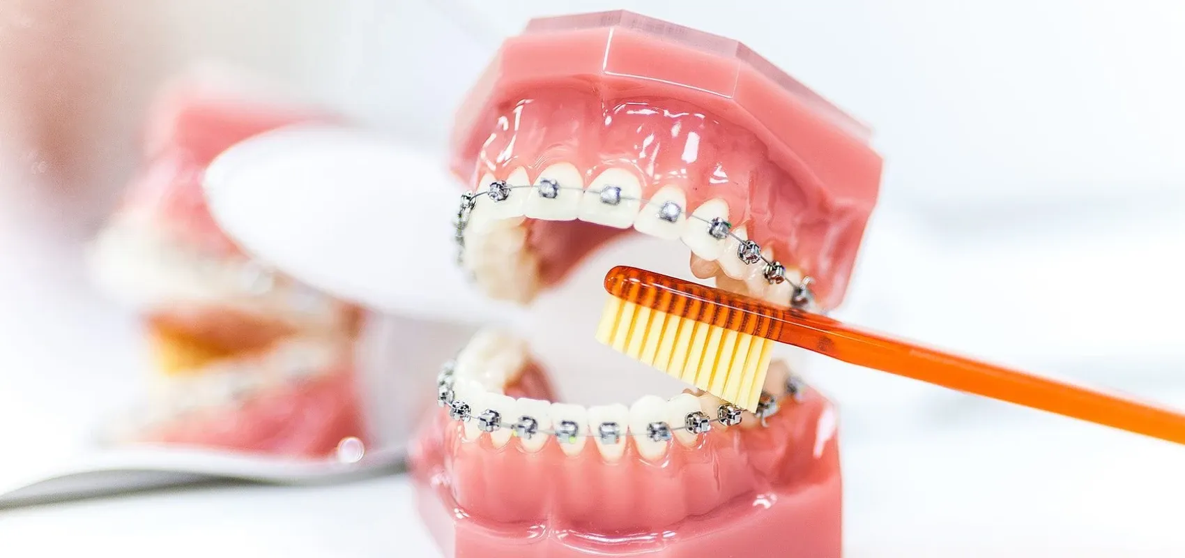 Orthodontiste Puteaux 92800