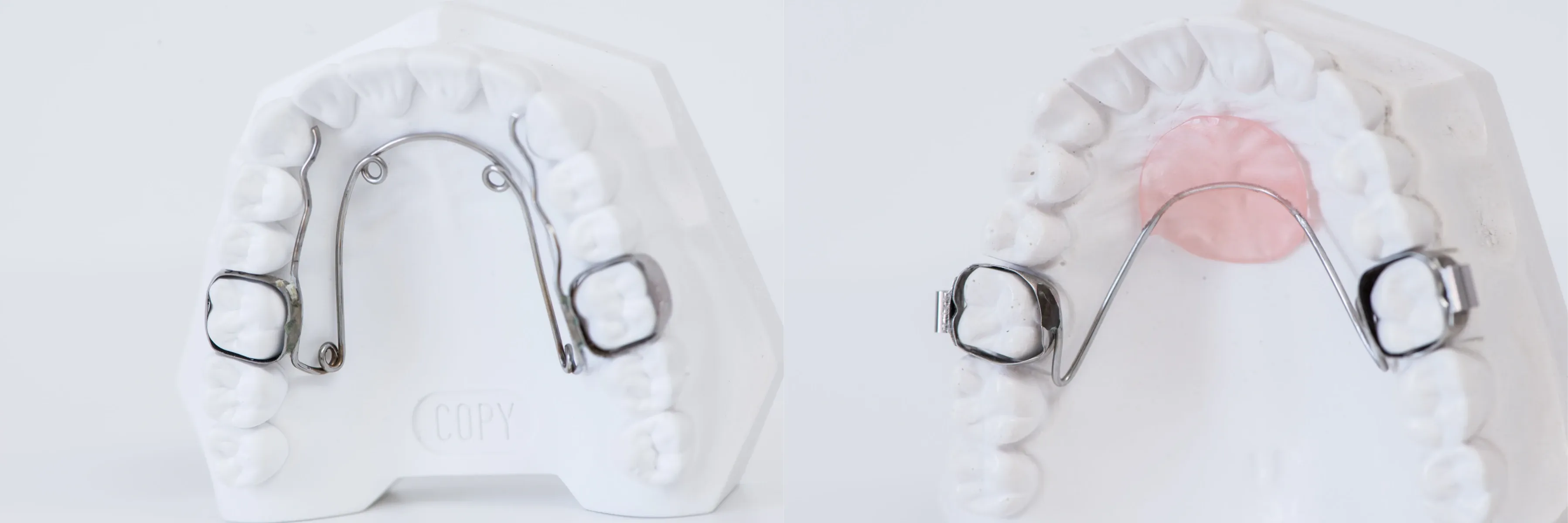 Orthodontiste enfant Puteaux 92800